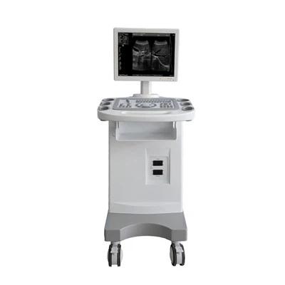 Troli b/w uwchsain FTL-UTS80